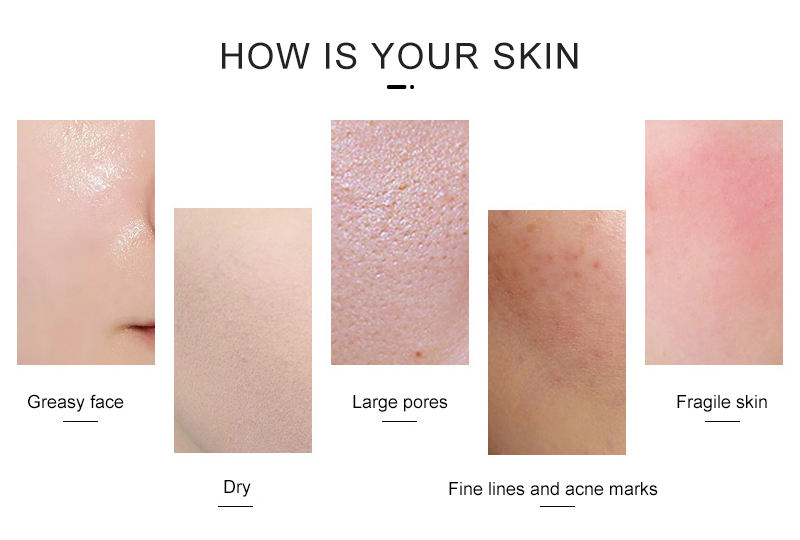 High quality Oxgen Facial Machine Hyperbaric Spray beaut O2derm oxyge Facial Mask Dome Therapy oxyge infusio Facial Machine