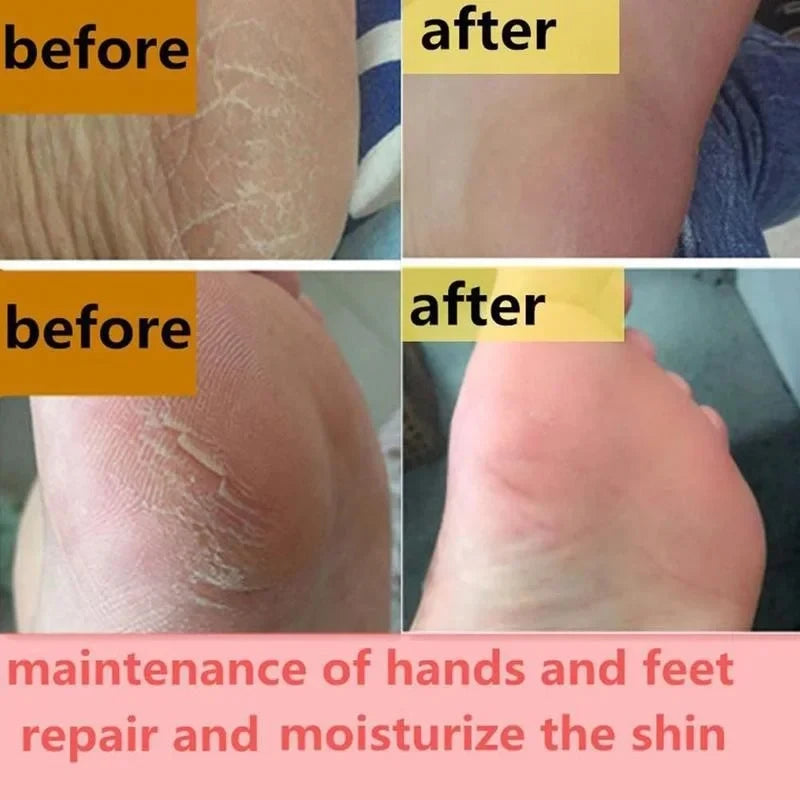 Herbal Anti Crack Foot Cream Heel Crack Repair Products Exfoliating Dead Skin Removal Softening Moisturising Smoothing Skin Care