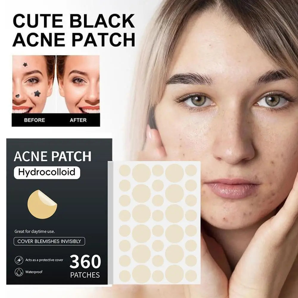 Acne Pimple Patch Stickers Acne Pimple Remover Tool Absorb Pus And Oil Acne Patch Face Skin Care 360 Patches