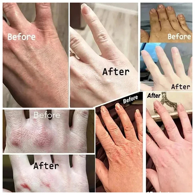 Wrinkle Removal Hand Cream Repair Hand Anti-drying Anti-crack Care Soften Nourish Whiten Moisturizing Cracked Repair Product