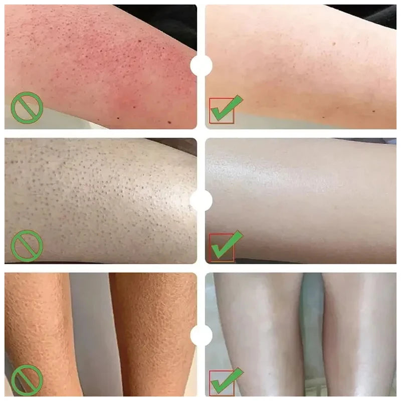 Herbal Anti Crack Foot Cream Heel Crack Repair Products Exfoliating Dead Skin Removal Softening Moisturising Smoothing Skin Care