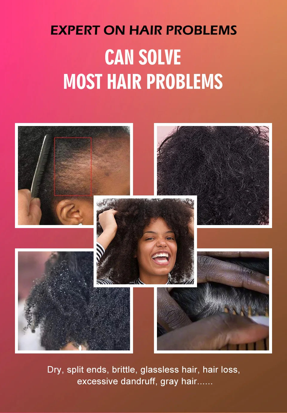 100% Pure Batana Oil From Honduras Natural Batana Butter For Hair Growth Alopecia Areata Hair Loss Treatment For Men & Women