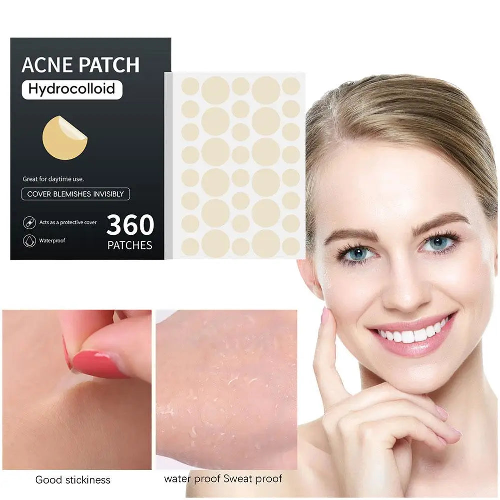 Acne Pimple Patch Stickers Acne Pimple Remover Tool Absorb Pus And Oil Acne Patch Face Skin Care 360 Patches