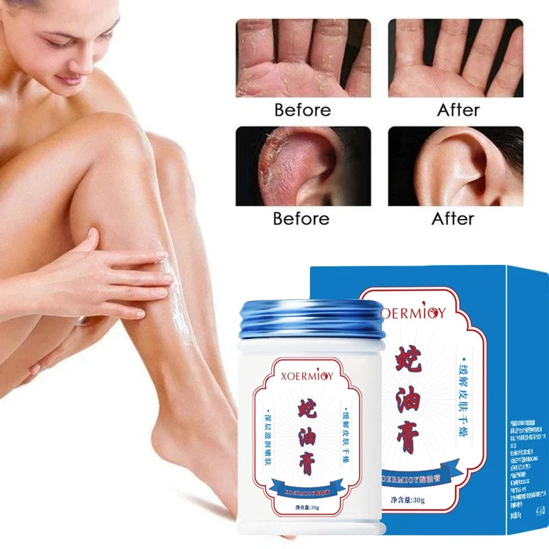 Herbal Anti Crack Foot Cream Heel Crack Repair Products Exfoliating Dead Skin Removal Softening Moisturising Smoothing Skin Care