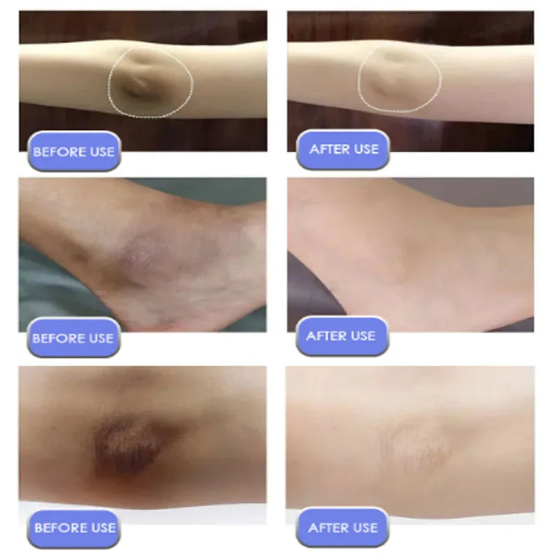 Body Whitening Cream For Dark Skin Intimate Area Pink Essence Dullness Brighten Skin Whitener Beauty Health For Dropshipping 20g