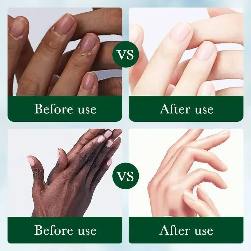 Fast Whitening Dark Knuckles Hand Cream Brighten Moisturizing Intense Stains Remover Melanin Corrector Products hand Skin Care