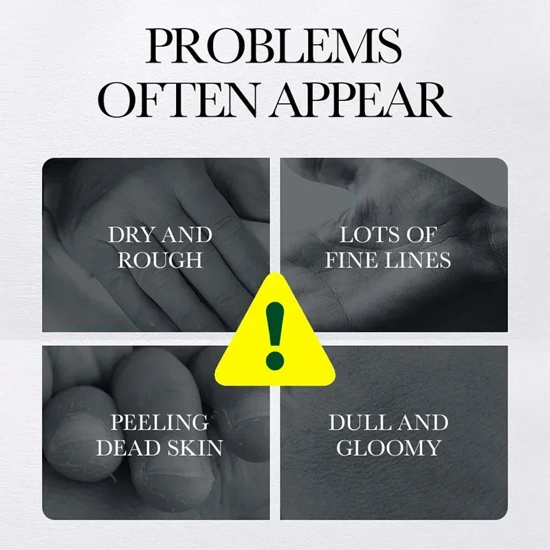 Fast Whitening Dark Knuckles Hand Cream Brighten Moisturizing Intense Stains Remover Melanin Corrector Products hand Skin Care