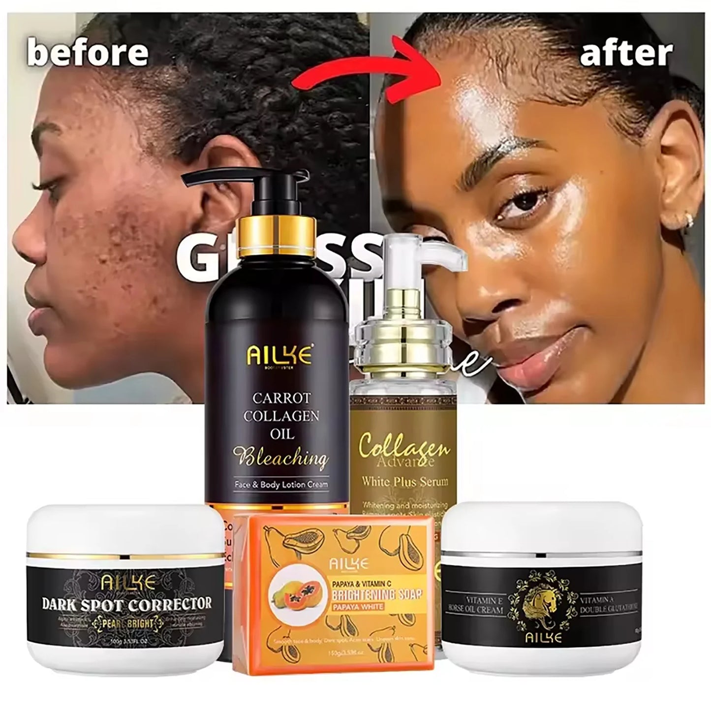 AILKE Collagen 5 in 1 Skin Care Kit, Restore Skin Elasticity, Smooth Skin, Brighten, Even Skin Tone, For Face And Body Use Set