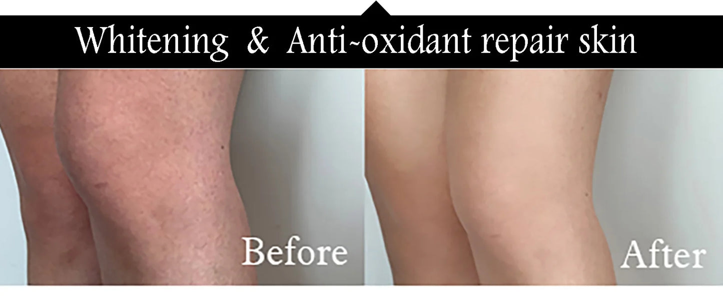 AILKE Collagen 5 in 1 Skin Care Kit, Restore Skin Elasticity, Smooth Skin, Brighten, Even Skin Tone, For Face And Body Use Set