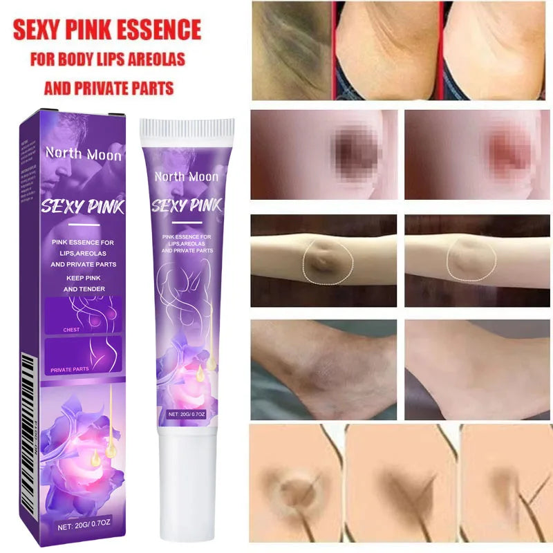 Body Whitening Cream For Dark Skin Intimate Area Pink Essence Dullness Brighten Skin Whitener Beauty Health For Dropshipping 20g