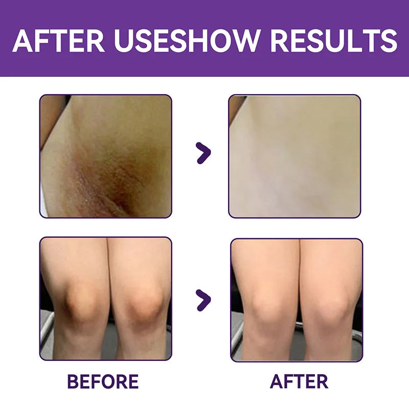 Body Whitening Cream For Dark Skin Intimate Area Pink Essence Dullness Brighten Skin Whitener Beauty Health For Dropshipping 20g