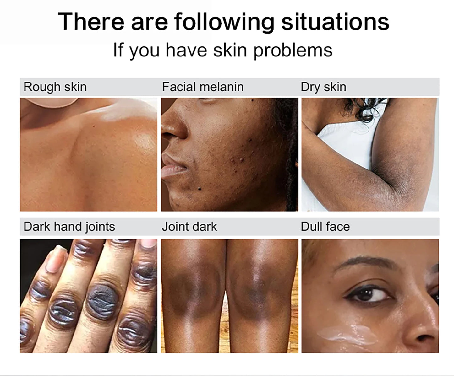 AILKE Glutathione Lighten Body Lotion, Moisturizing, Hydration, Even Skin tone, Improve Dark & Black Skin, Support Private logo