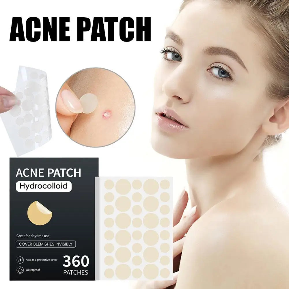 Acne Pimple Patch Stickers Acne Pimple Remover Tool Absorb Pus And Oil Acne Patch Face Skin Care 360 Patches