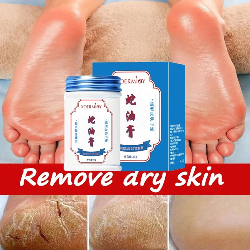 Herbal Anti Crack Foot Cream Heel Crack Repair Products Exfoliating Dead Skin Removal Softening Moisturising Smoothing Skin Care