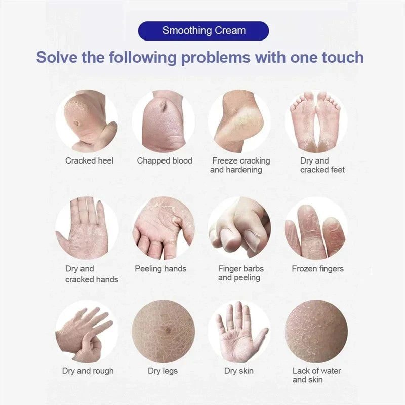 Herbal Anti Crack Foot Cream Heel Crack Repair Products Exfoliating Dead Skin Removal Softening Moisturising Smoothing Skin Care