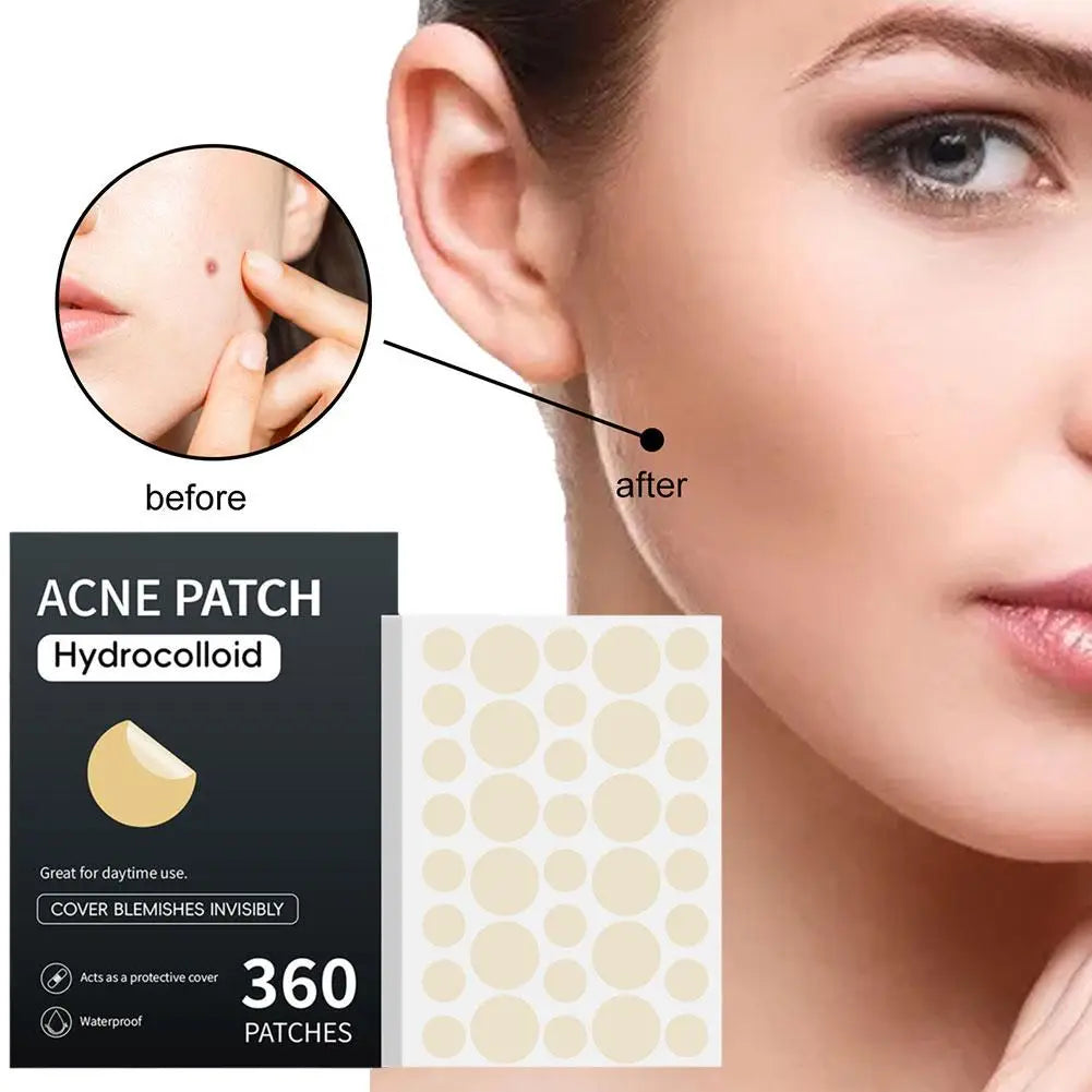 Acne Pimple Patch Stickers Acne Pimple Remover Tool Absorb Pus And Oil Acne Patch Face Skin Care 360 Patches