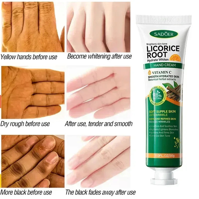 Fast Whitening Dark Knuckles Hand Cream Brighten Moisturizing Intense Stains Remover Melanin Corrector Products hand Skin Care