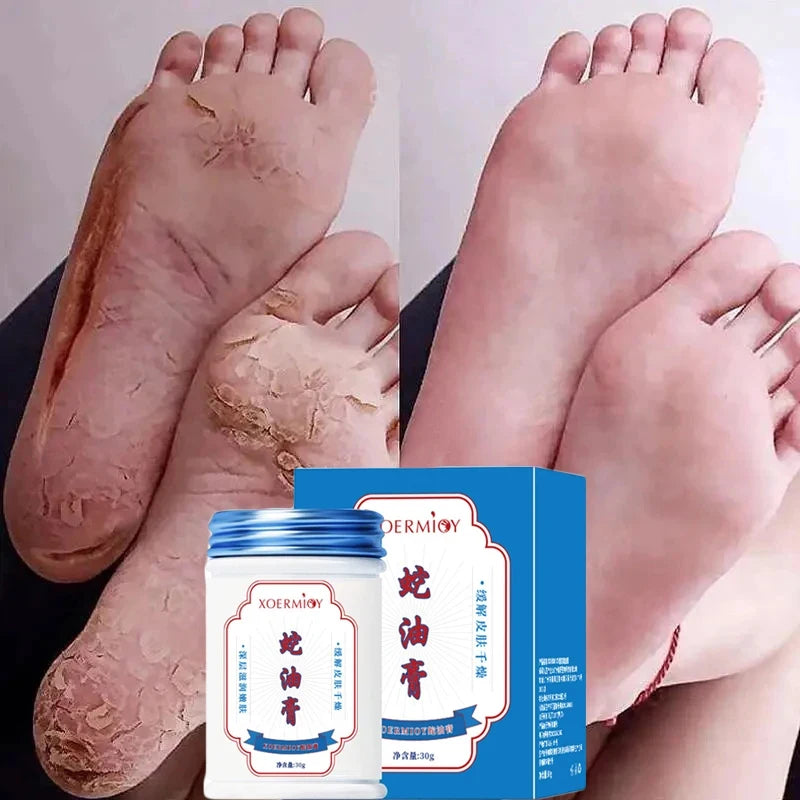 Herbal Anti Crack Foot Cream Heel Crack Repair Products Exfoliating Dead Skin Removal Softening Moisturising Smoothing Skin Care