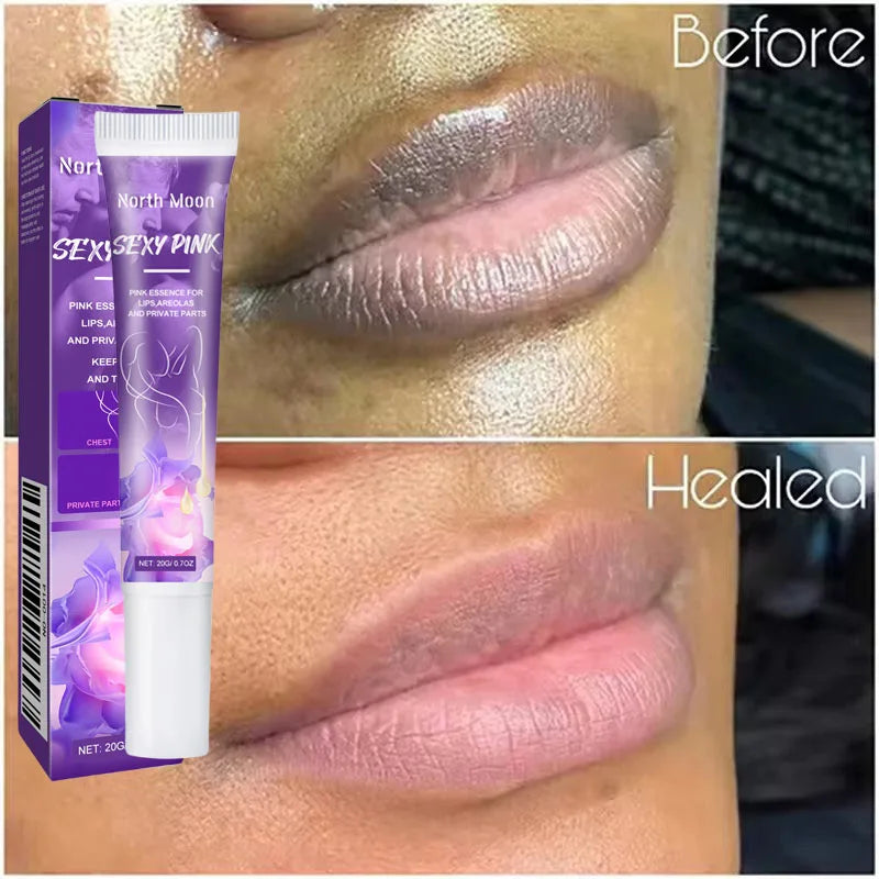 Body Whitening Cream For Dark Skin Intimate Area Pink Essence Dullness Brighten Skin Whitener Beauty Health For Dropshipping 20g