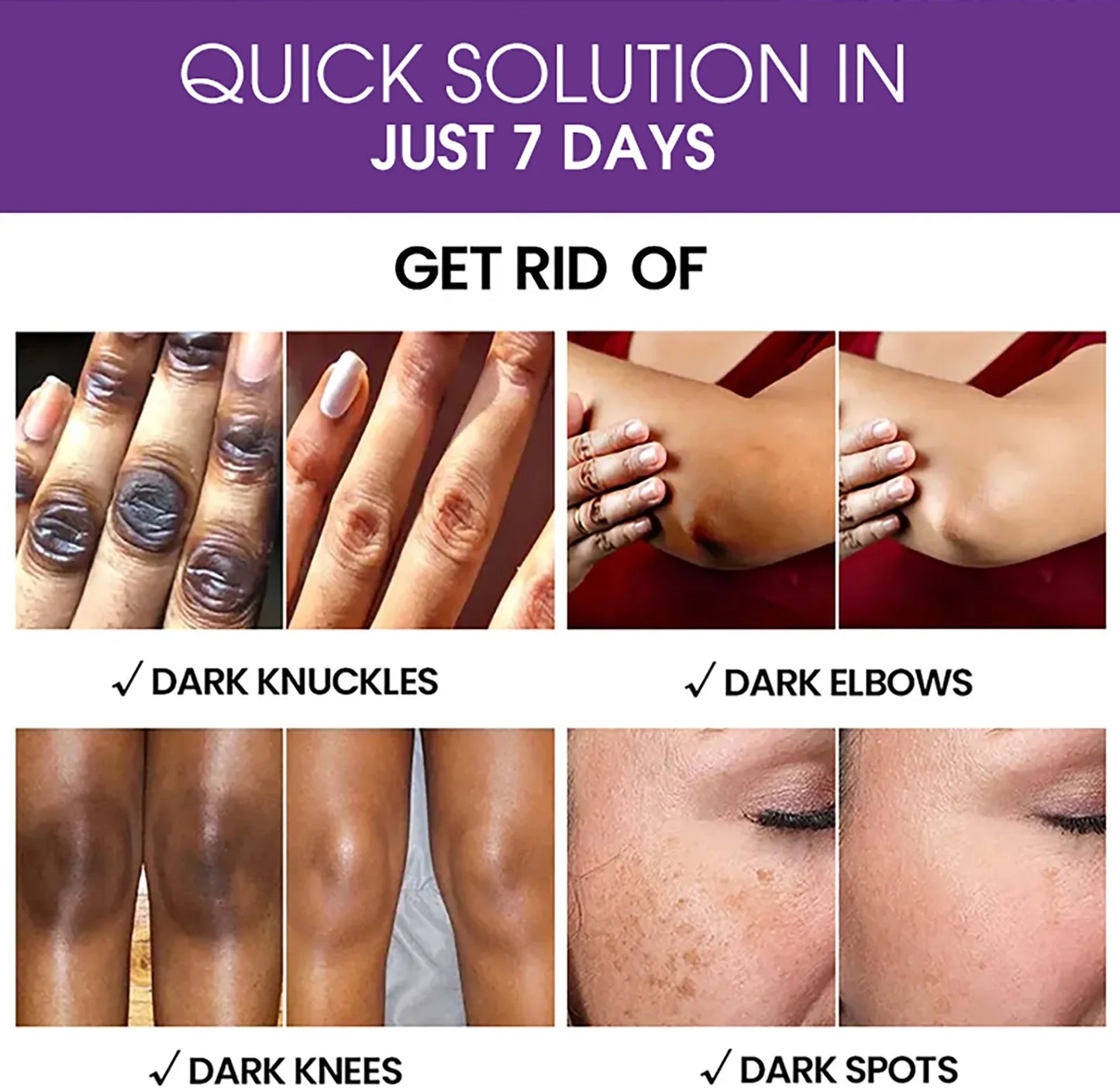 AILKE Glutathione Lighten Body Lotion, Moisturizing, Hydration, Even Skin tone, Improve Dark & Black Skin, Support Private logo