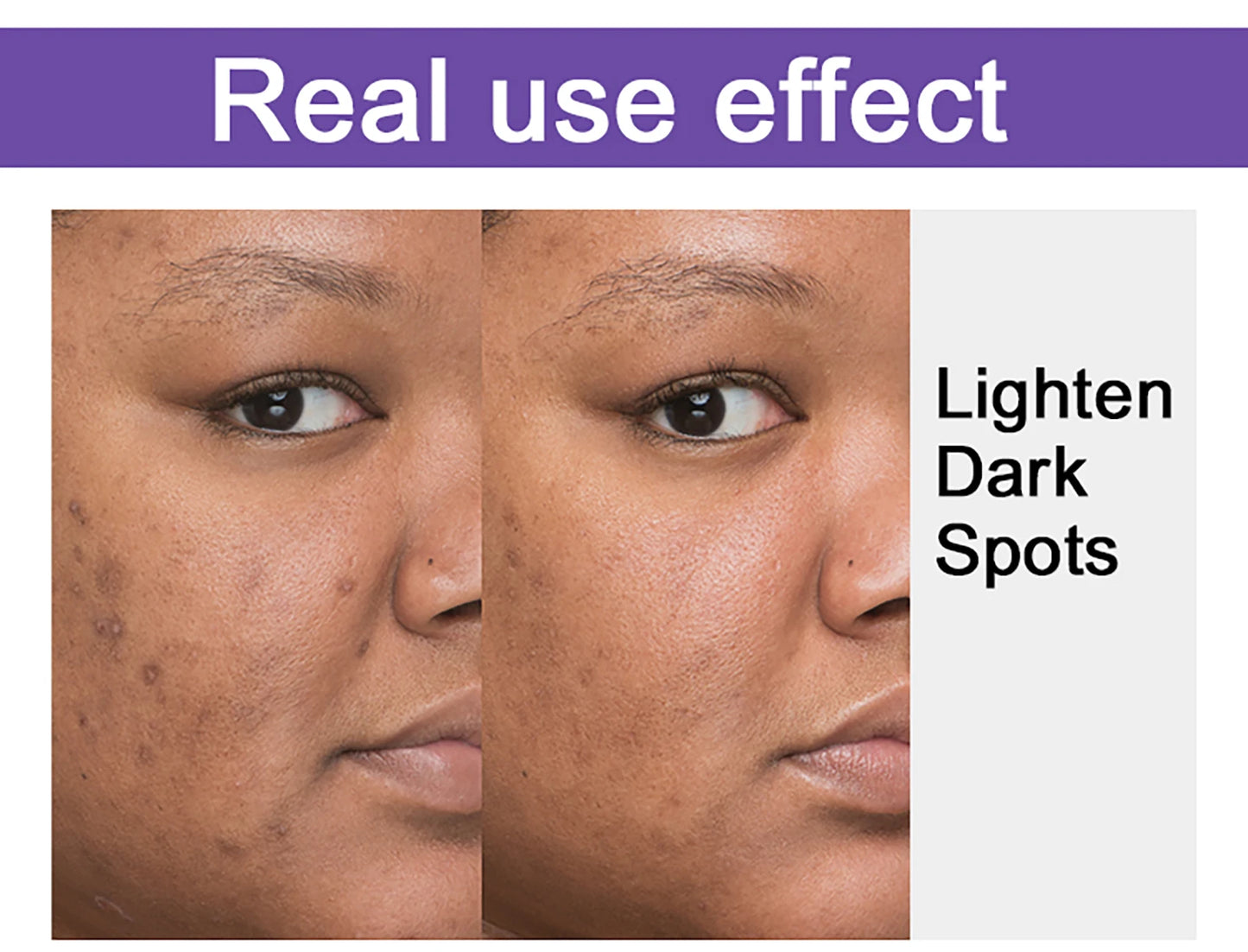 AILKE Glutathione Lighten Body Lotion, Moisturizing, Hydration, Even Skin tone, Improve Dark & Black Skin, Support Private logo