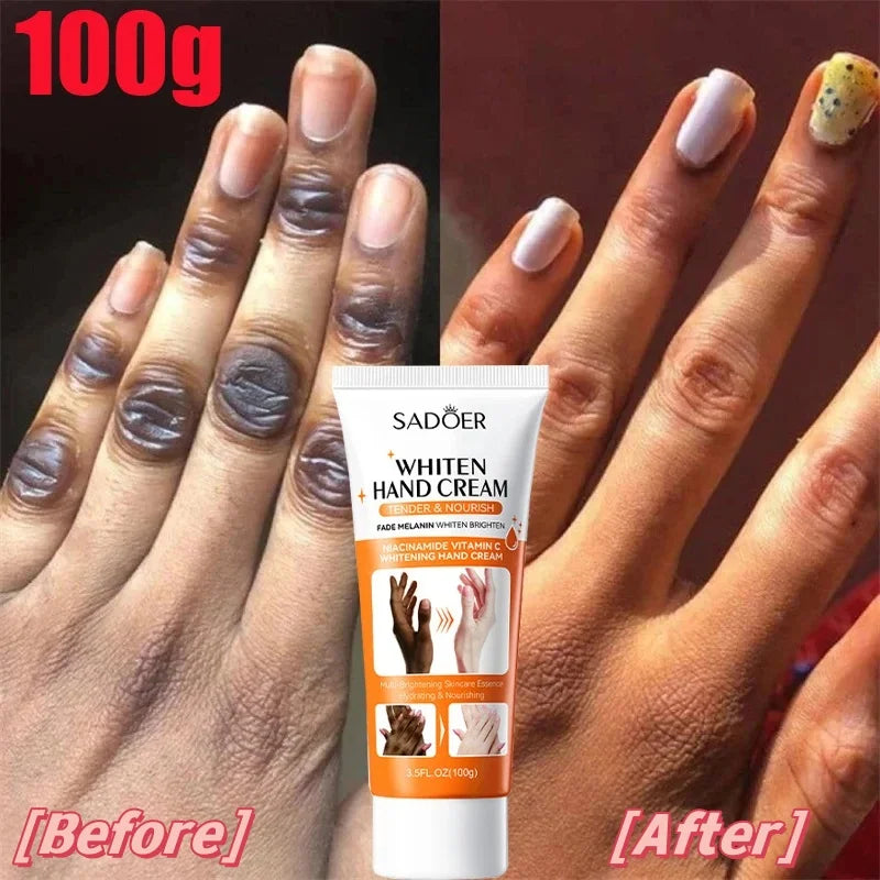 Dark Knuckles Fast Whitening Serum Anti Cracking Cream Pigmentation Correctors For Intense Stains Fast Stains Remover Products