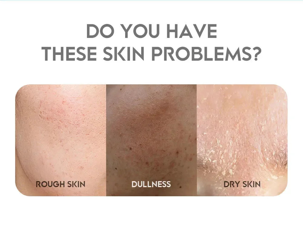 Sakura Whitening Essence Face Cream Anti-Aging Moisturizer Wrinkle Remover Remove Dark Spots Shrink Pore Brighten Glow Skin Care