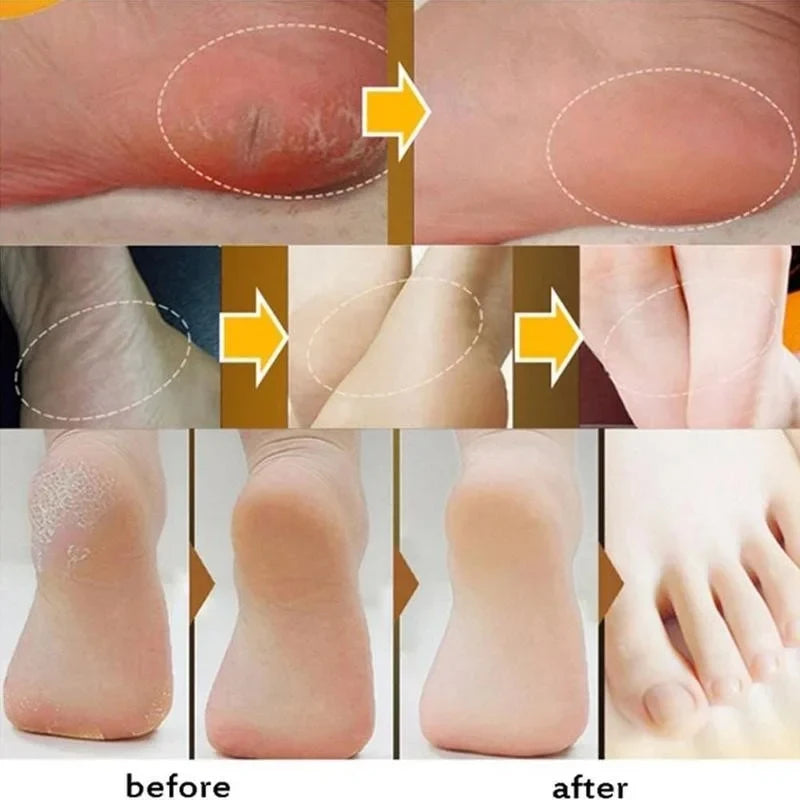 Herbal Anti Crack Foot Cream Heel Crack Repair Products Exfoliating Dead Skin Removal Softening Moisturising Smoothing Skin Care