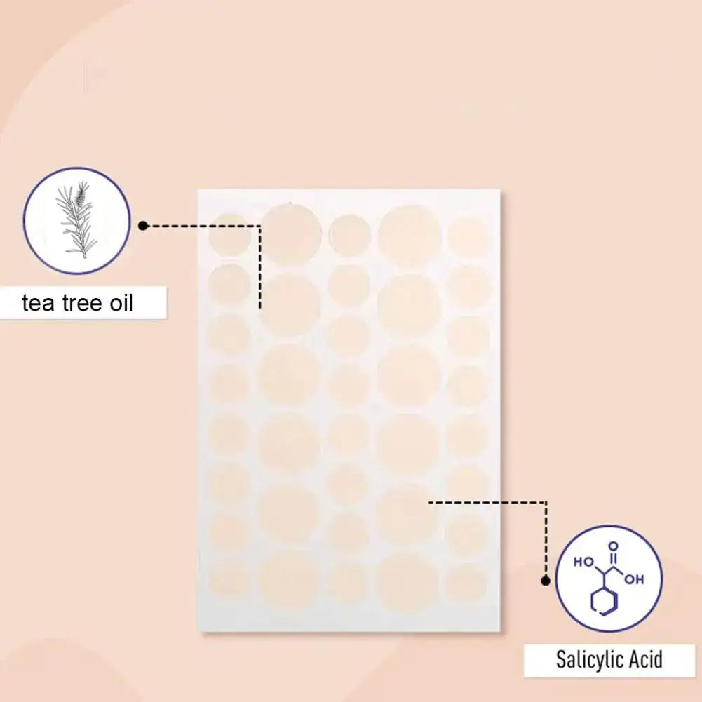 Acne Pimple Patch Stickers Acne Pimple Remover Tool Absorb Pus And Oil Acne Patch Face Skin Care 360 Patches